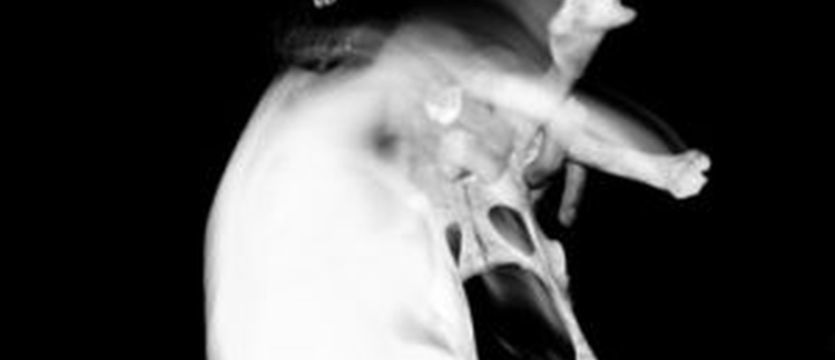 What’s so Negative About Psychoanalysis?